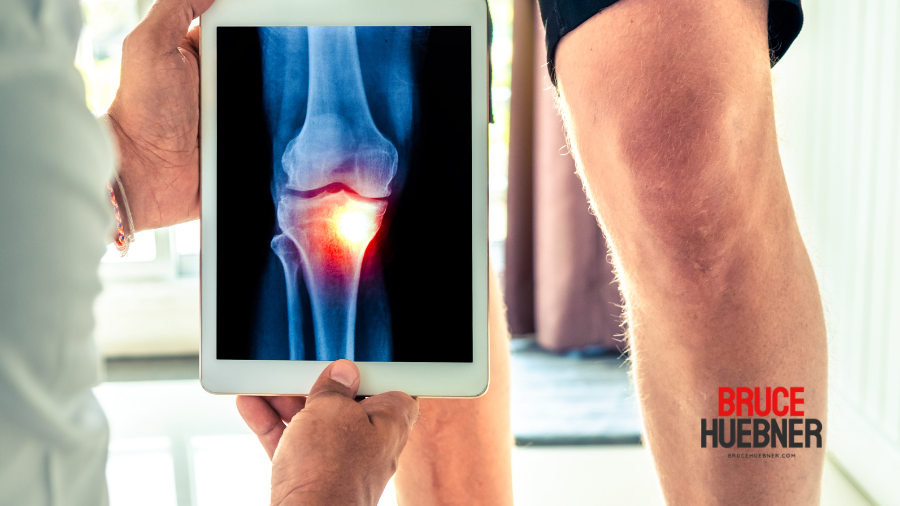 Managing osteoarthritis in the elderly